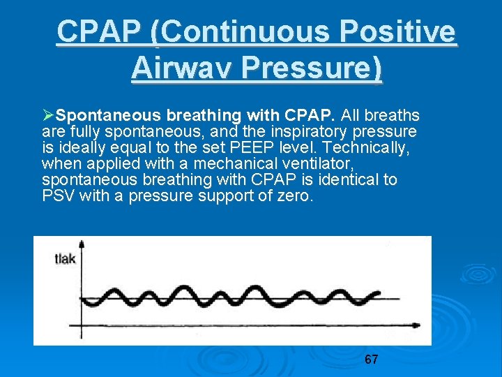 CPAP (Continuous Positive Airwav Pressure) Spontaneous breathing with CPAP. All breaths are fully spontaneous,