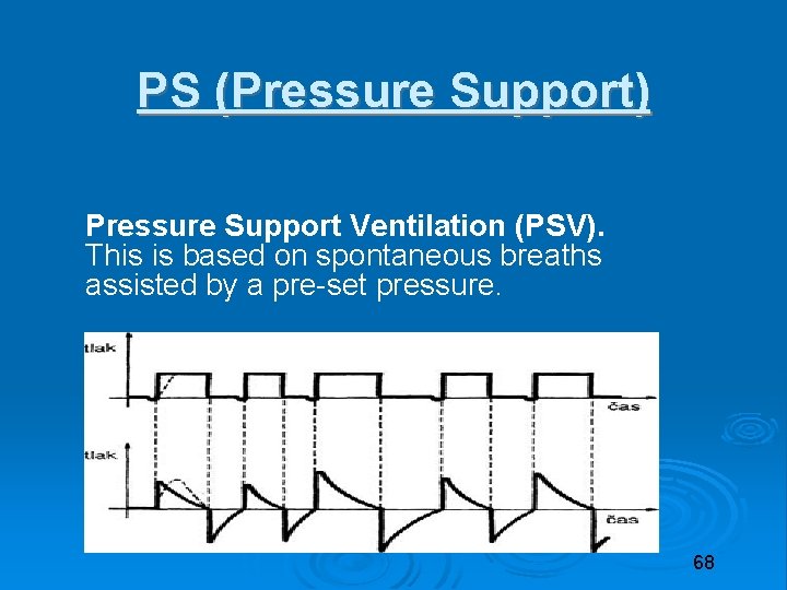 PS (Pressure Support) Pressure Support Ventilation (PSV). This is based on spontaneous breaths assisted