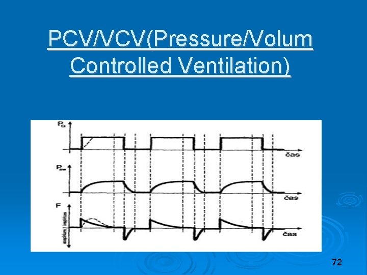 PCV/VCV(Pressure/Volum Controlled Ventilation) 72 