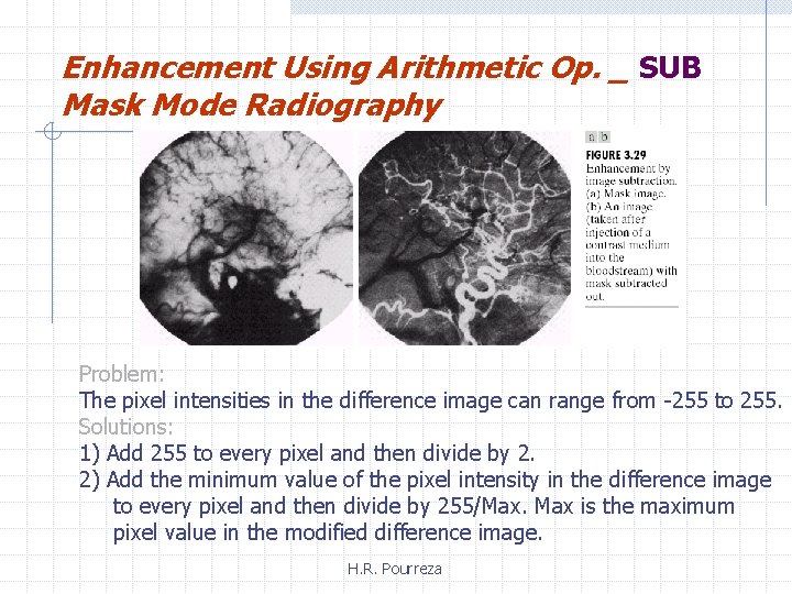 Enhancement Using Arithmetic Op. _ SUB Mask Mode Radiography Problem: The pixel intensities in