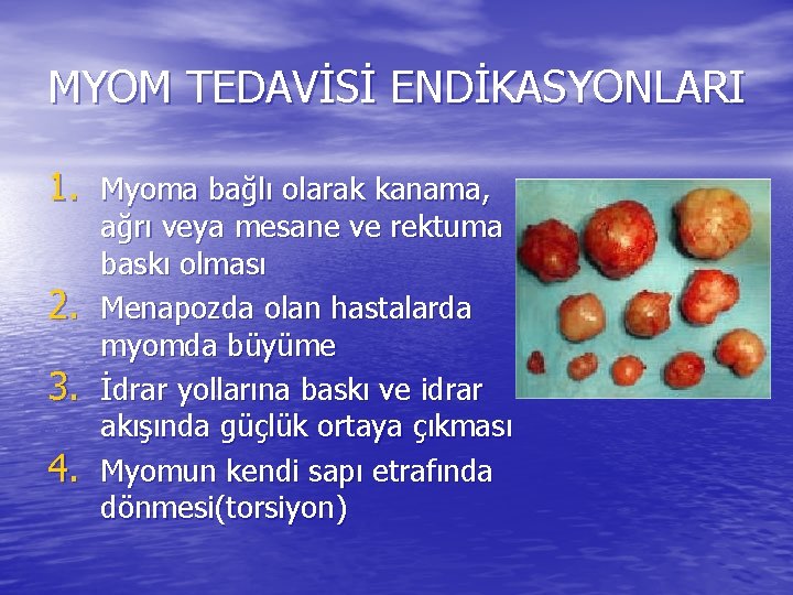 MYOM TEDAVİSİ ENDİKASYONLARI 1. Myoma bağlı olarak kanama, 2. 3. 4. ağrı veya mesane