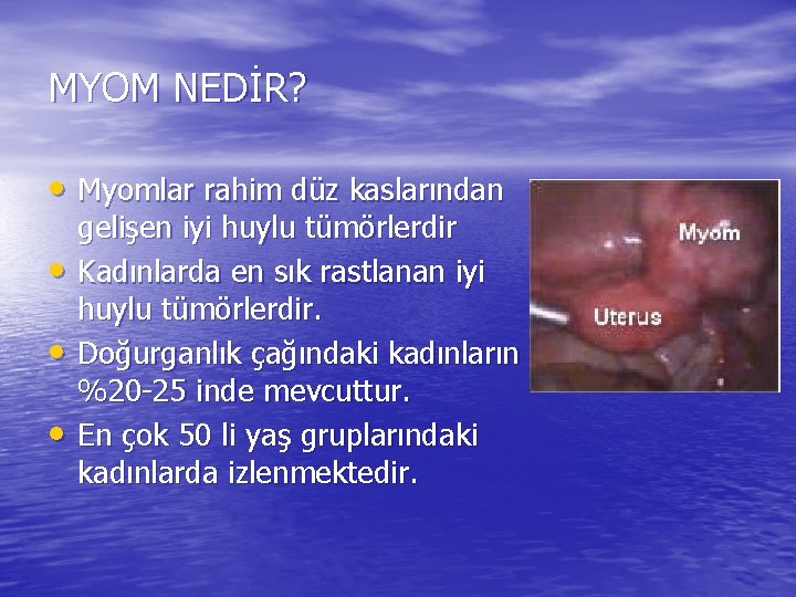 MYOM NEDİR? • Myomlar rahim düz kaslarından • • • gelişen iyi huylu tümörlerdir