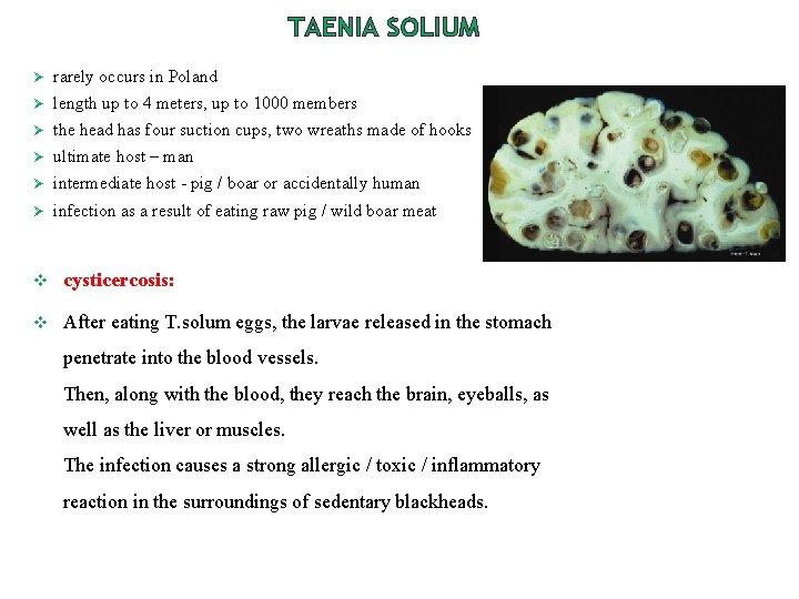 TAENIA SOLIUM Ø rarely occurs in Poland Ø length up to 4 meters, up TAENIA SOLIUM Ø rarely occurs in Poland Ø length up to 4 meters, up