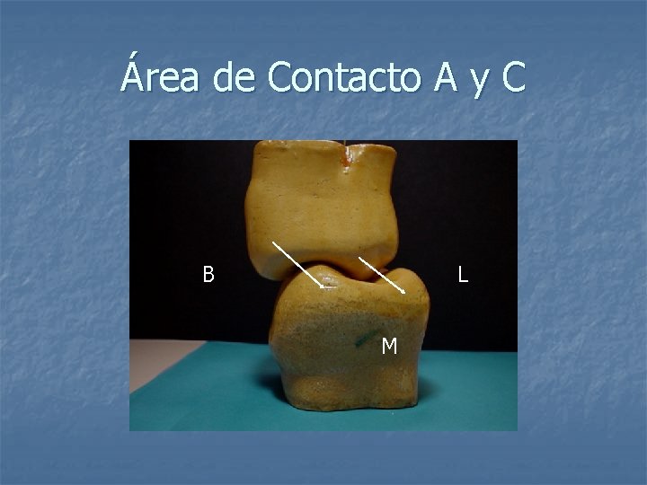 Área de Contacto A y C B L M 