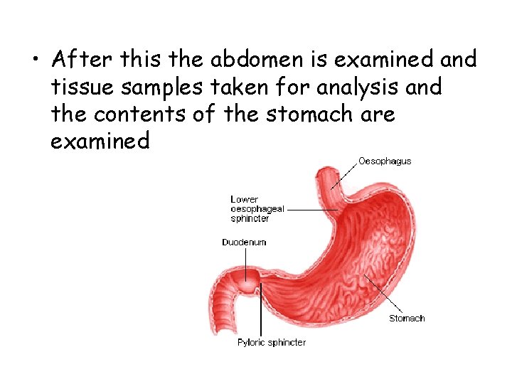  • After this the abdomen is examined and tissue samples taken for analysis
