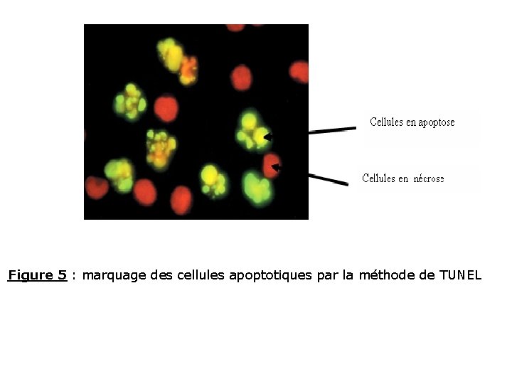 Figure 5 : marquage des cellules apoptotiques par la méthode de TUNEL 