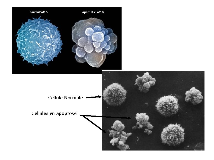  Cellule Normale Cellules en apoptose 