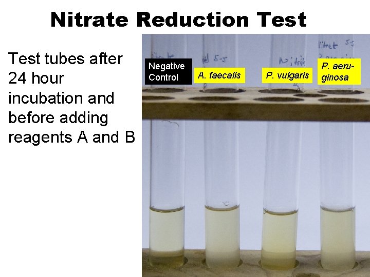 Nitrate Reduction Test tubes after 24 hour incubation and before adding reagents A and