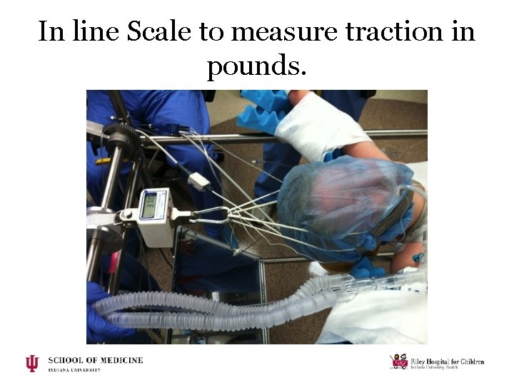 In line Scale to measure traction in pounds. In line Scale to measure traction in pounds.