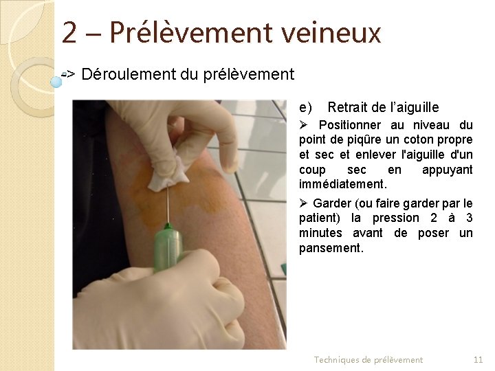 2 – Prélèvement veineux -> Déroulement du prélèvement e) Retrait de l’aiguille Ø Positionner