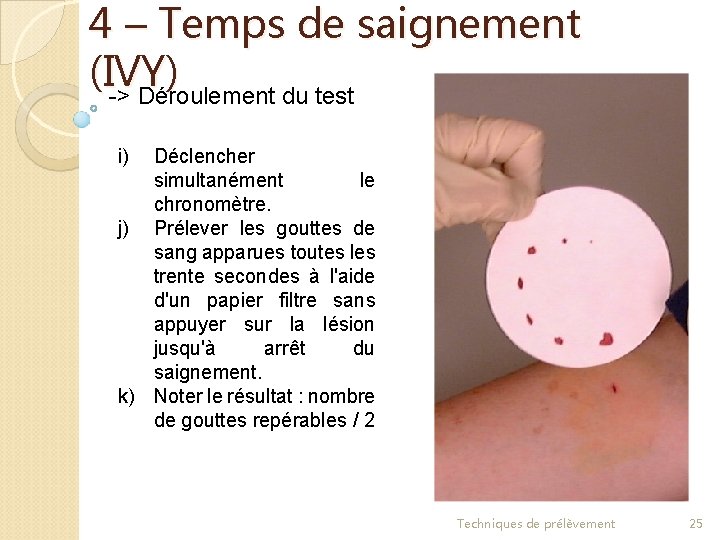 4 – Temps de saignement (IVY) -> Déroulement du test i) Déclencher simultanément le