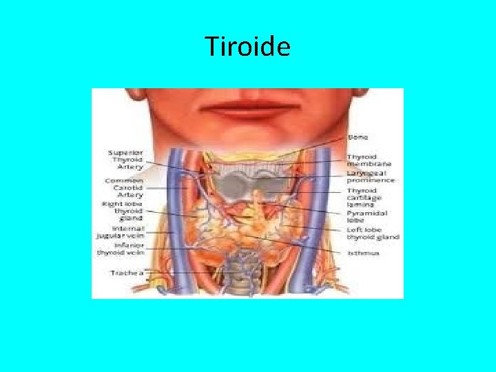 Tiroide 
