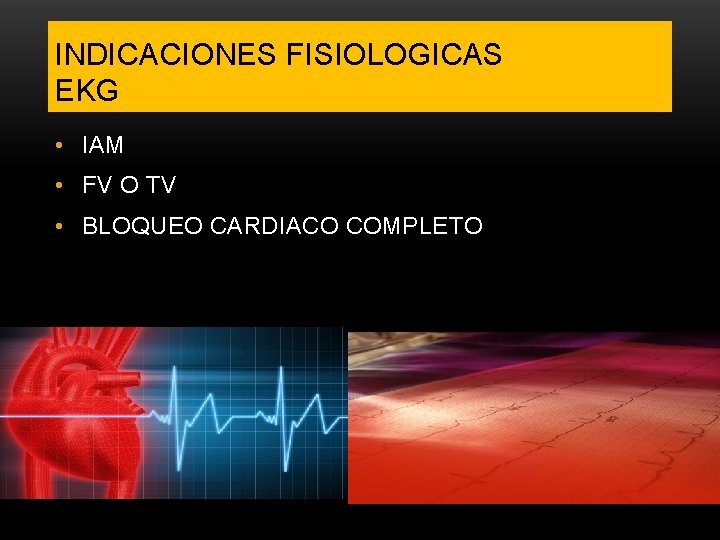 INDICACIONES FISIOLOGICAS EKG • IAM • FV O TV • BLOQUEO CARDIACO COMPLETO 