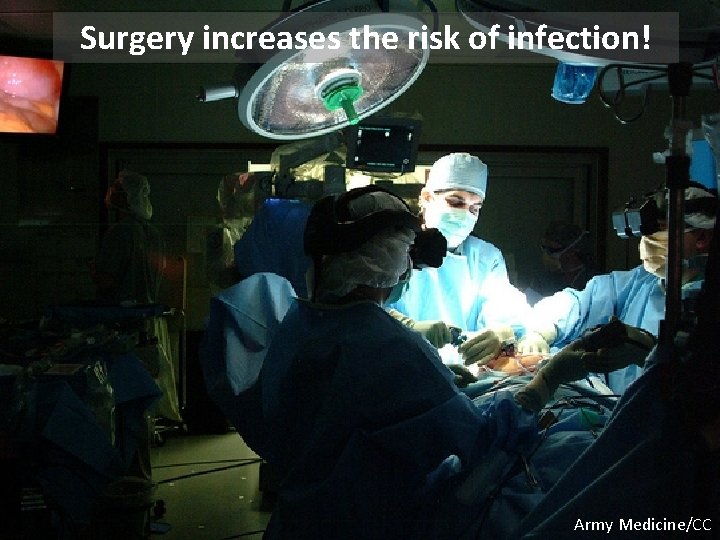 Surgery increases the risk of infection! Army Medicine/CC Surgery increases the risk of infection! Army Medicine/CC