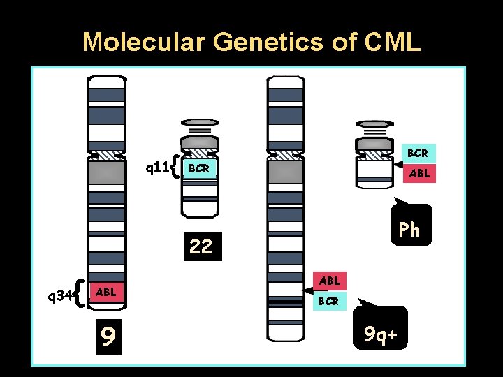Molecular Genetics of CML { q 11 BCR ABL Ph 22 { q 34