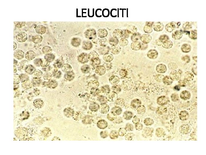 LEUCOCITI 