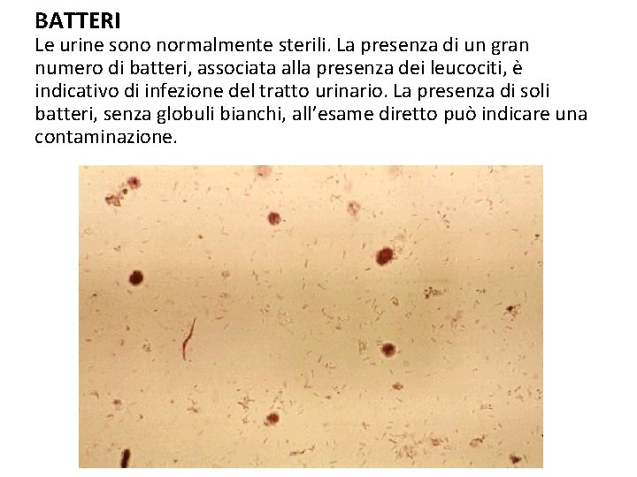 BATTERI Le urine sono normalmente sterili. La presenza di un gran numero di batteri,