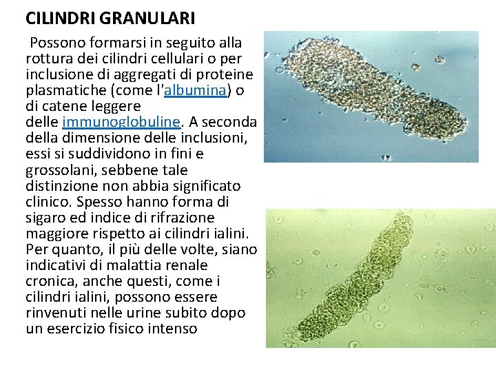 CILINDRI GRANULARI Possono formarsi in seguito alla rottura dei cilindri cellulari o per inclusione