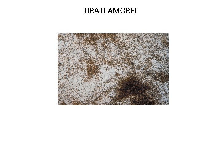 URATI AMORFI 