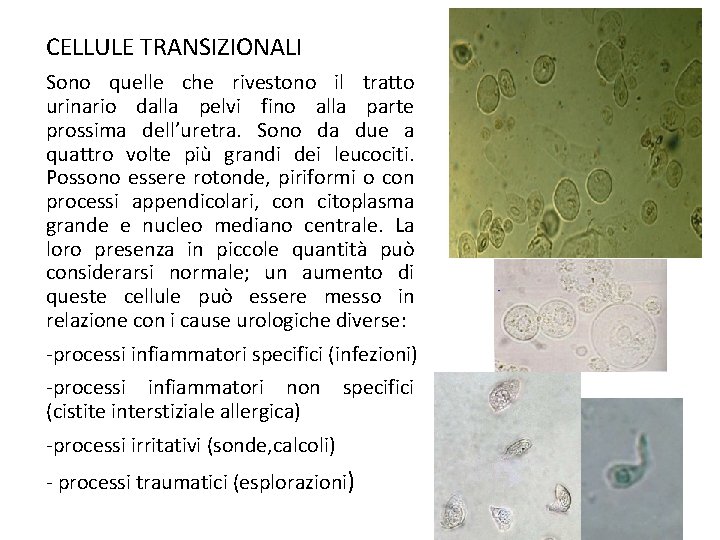 CELLULE TRANSIZIONALI Sono quelle che rivestono il tratto urinario dalla pelvi fino alla parte