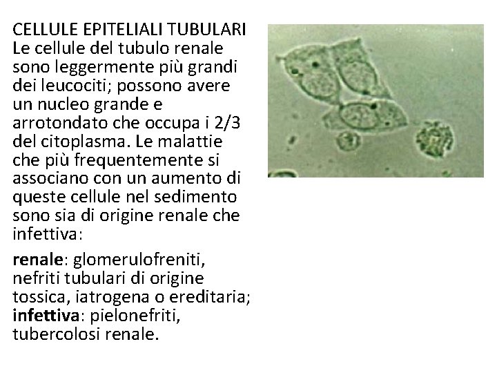 CELLULE EPITELIALI TUBULARI Le cellule del tubulo renale sono leggermente più grandi dei leucociti;