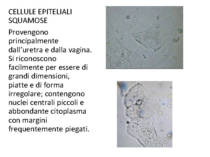 CELLULE EPITELIALI SQUAMOSE Provengono principalmente dall’uretra e dalla vagina. Si riconoscono facilmente per essere