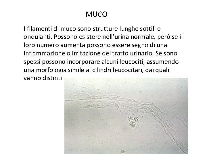  MUCO I filamenti di muco sono strutture lunghe sottili e ondulanti. Possono esistere