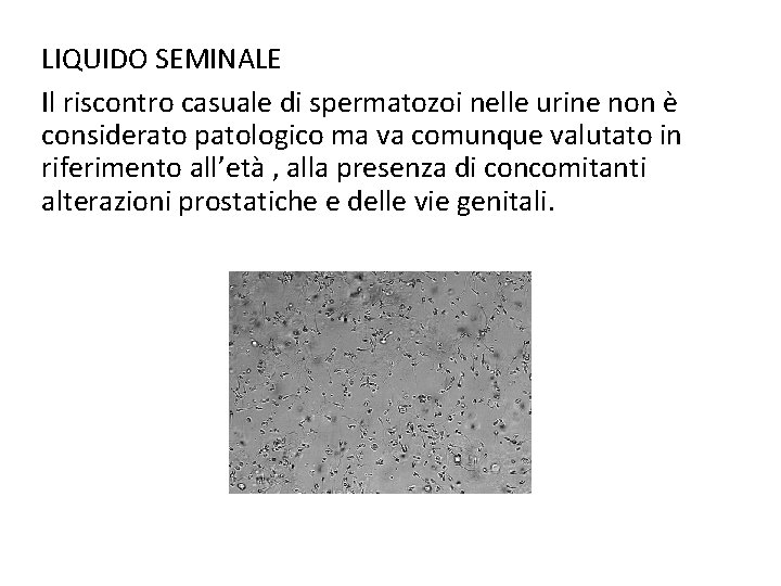 LIQUIDO SEMINALE Il riscontro casuale di spermatozoi nelle urine non è considerato patologico ma