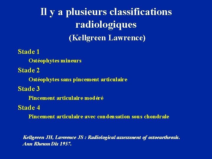 Il y a plusieurs classifications radiologiques (Kellgreen Lawrence) Stade 1 Ostéophytes mineurs Stade 2