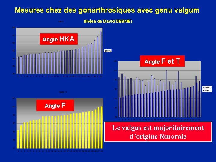 Mesures chez des gonarthrosiques avec genu valgum (thèse de David DESME) Angle HKA Angle