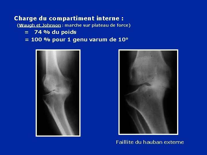 Charge du compartiment interne : (Waugh et Johnson : marche sur plateau de force)