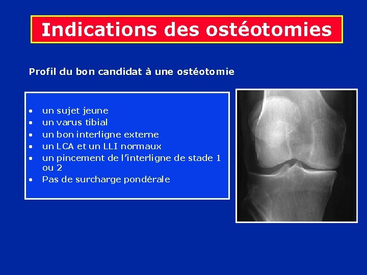 Indications des ostéotomies Profil du bon candidat à une ostéotomie • • • un