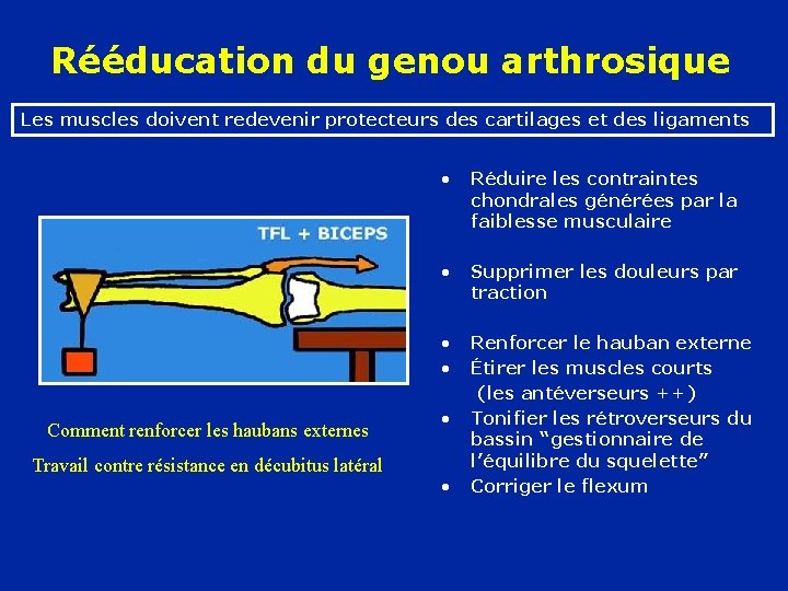 Rééducation du genou arthrosique Les muscles doivent redevenir protecteurs des cartilages et des ligaments