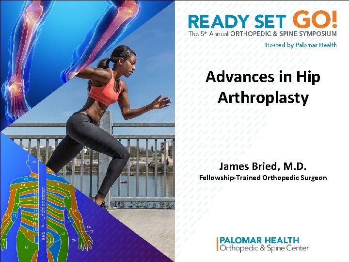Advances in Hip Arthroplasty James Bried, M. D. Fellowship-Trained Orthopedic Surgeon 
