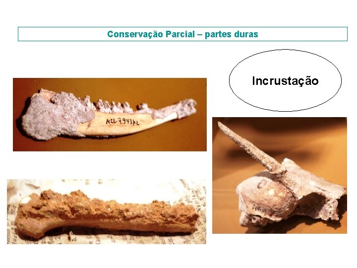 Conservação Parcial – partes duras Incrustação 