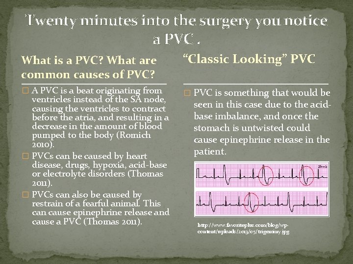 Twenty minutes into the surgery you notice a PVC. What is a PVC? What Twenty minutes into the surgery you notice a PVC. What is a PVC? What