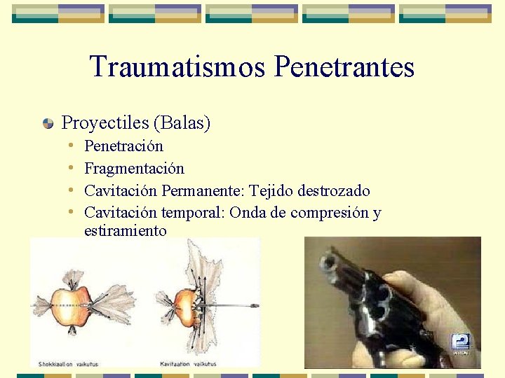 Traumatismos Penetrantes Proyectiles (Balas) • • Penetración Fragmentación Cavitación Permanente: Tejido destrozado Cavitación temporal: