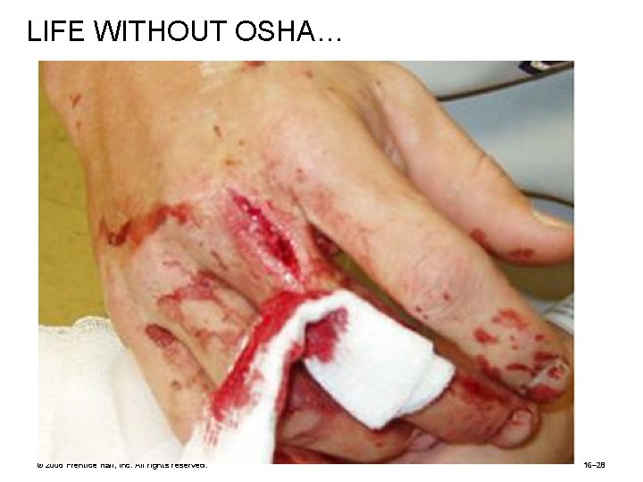 LIFE WITHOUT OSHA… © 2008 Prentice Hall, Inc. All rights reserved. 16– 28 