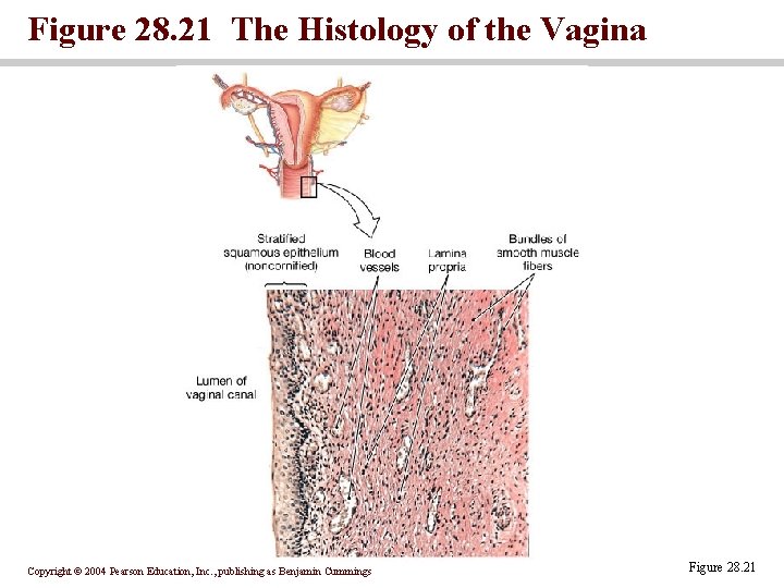 Figure 28. 21 The Histology of the Vagina Copyright © 2004 Pearson Education, Inc.