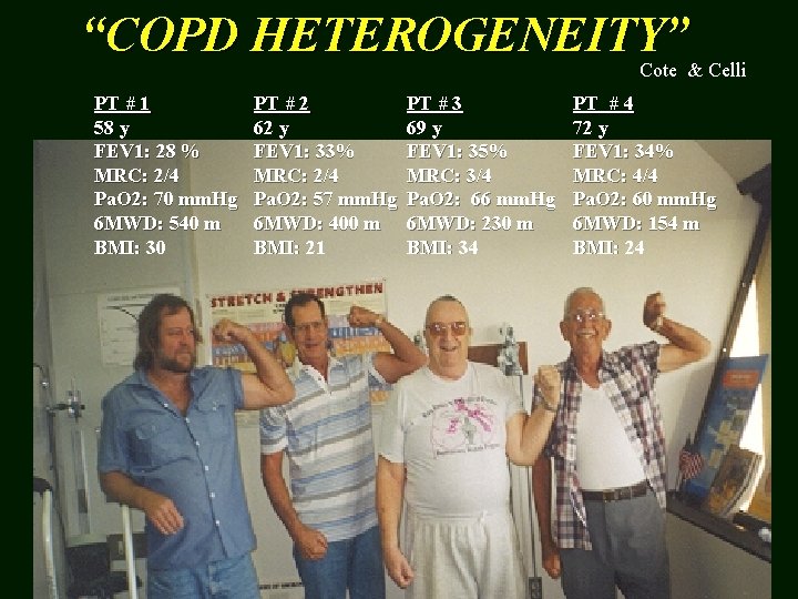 “COPD HETEROGENEITY” Cote & Celli PT # 1 58 y FEV 1: 28 %