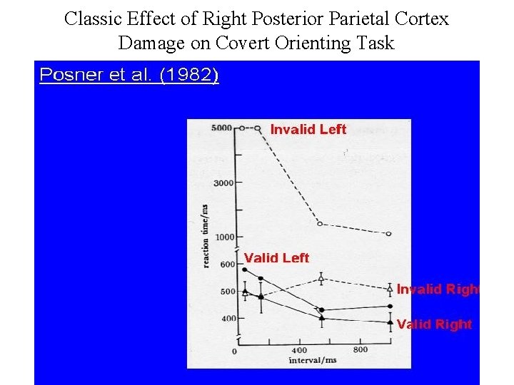 Classic Effect of Right Posterior Parietal Cortex Damage on Covert Orienting Task 