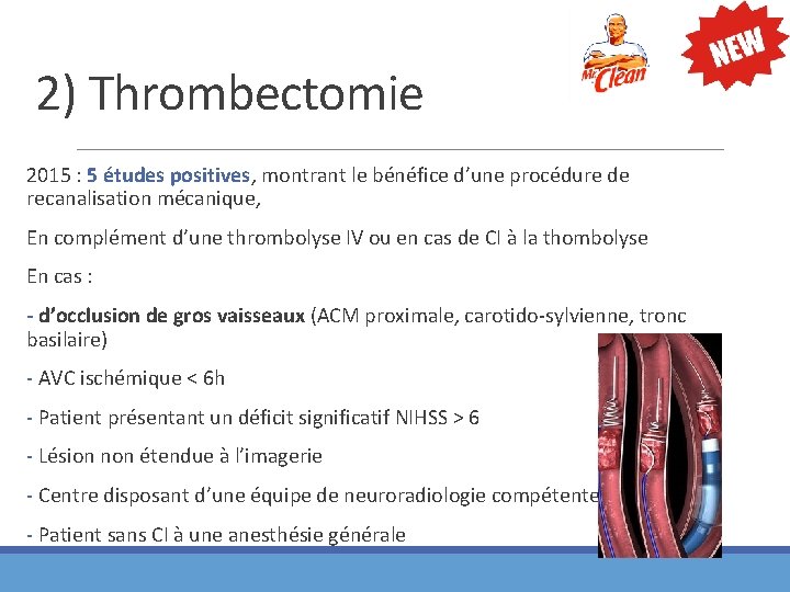 2) Thrombectomie 2015 : 5 études positives, montrant le bénéfice d’une procédure de recanalisation