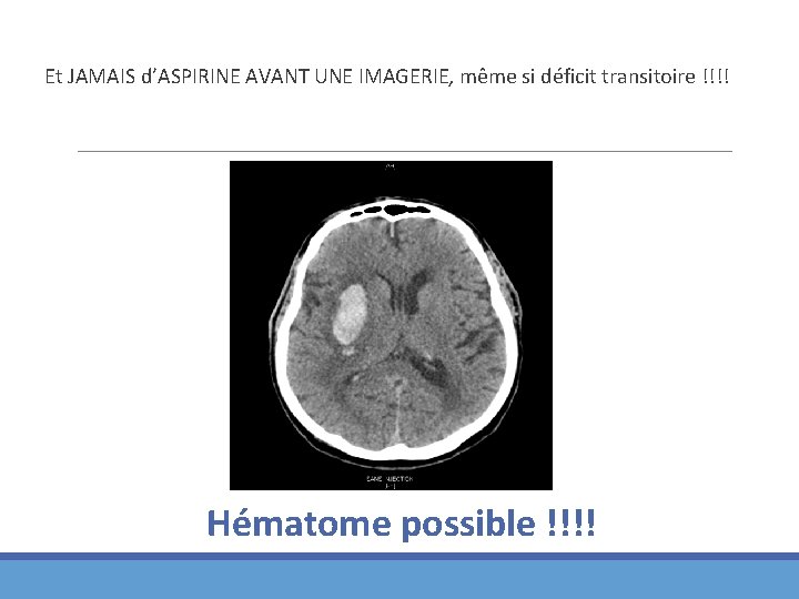 Et JAMAIS d’ASPIRINE AVANT UNE IMAGERIE, même si déficit transitoire !!!! Hématome possible !!!!
