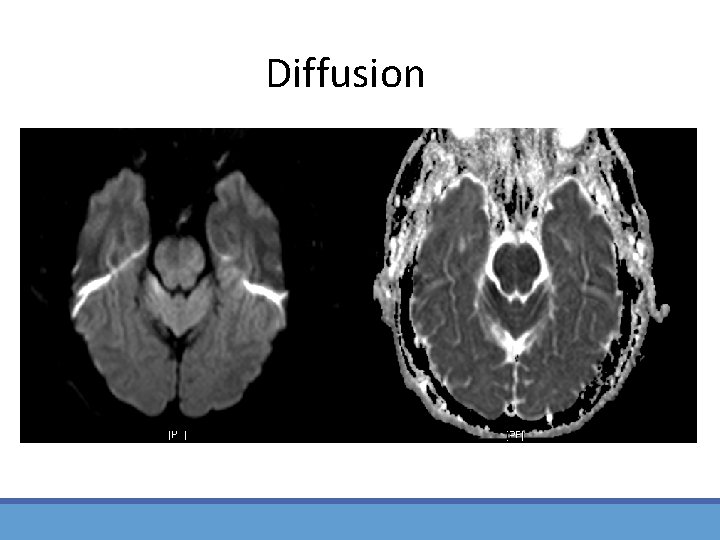 Diffusion 