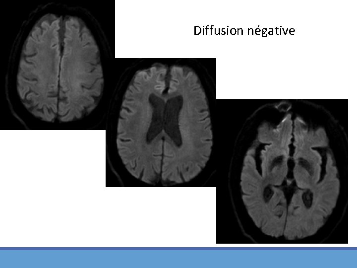 Diffusion négative 