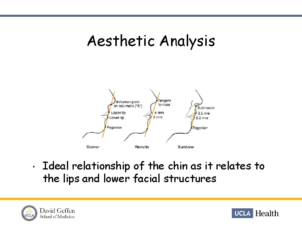 Aesthetic Analysis • Ideal relationship of the chin as it relates to the lips