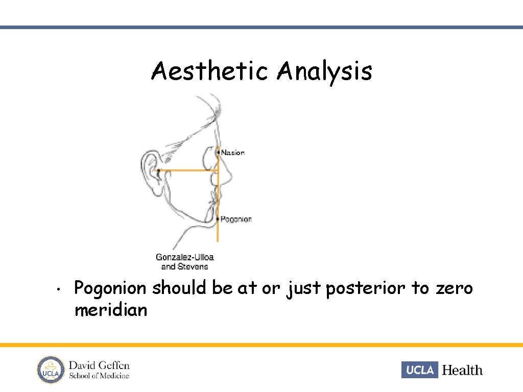 Aesthetic Analysis • Pogonion should be at or just posterior to zero meridian 