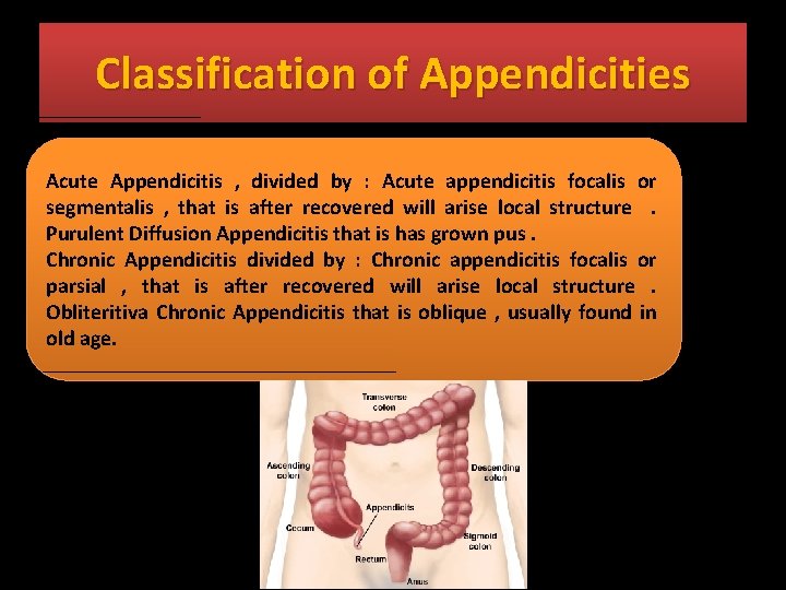 Classification of Appendicities Acute Appendicitis , divided by : Acute appendicitis focalis or segmentalis