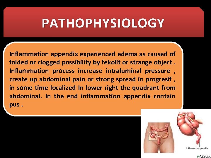 PATHOPHYSIOLOGY Inflammation appendix experienced edema as caused of folded or clogged possibility by fekolit