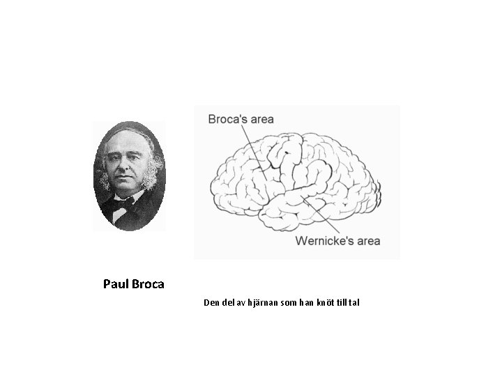 Paul Broca Den del av hjärnan som han knöt till tal 